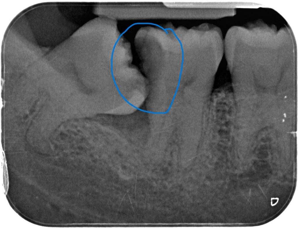 LEE MUN KONG 47 decay